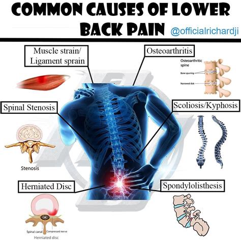 Have You Had Lower Back Pain Before It Has Been Caused By Lifting