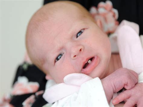 New Mum Stunned After Baby Girl Is Born With Fully Grown Tooth