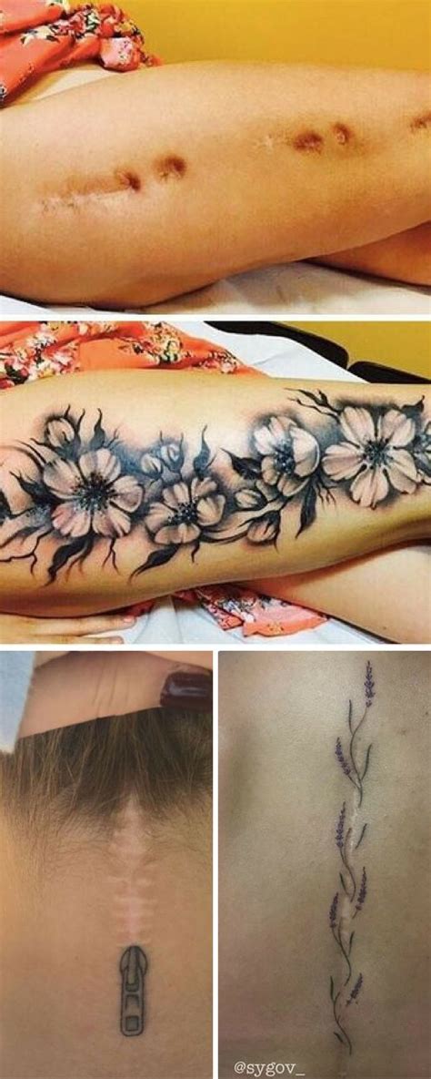 10 Brilliant Ways To Incorporate Scars With A Tattoo Design