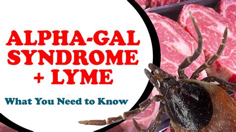 Alpha Gal Syndrome And Lyme What You Need To Know Lymeknowledge