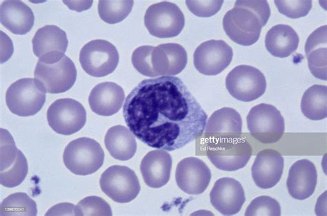Monocyte White Blood Cell Largest Leukocyte Has Horseshoeshaped Nucleus
