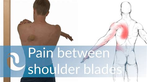 Relieve Pain Between Your Shoulder Blades Youtube