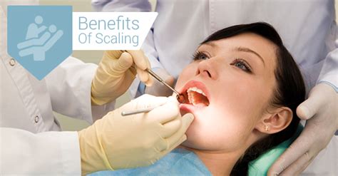 3 Benefits Of Scaling You Did Not Know City Oasis Dental