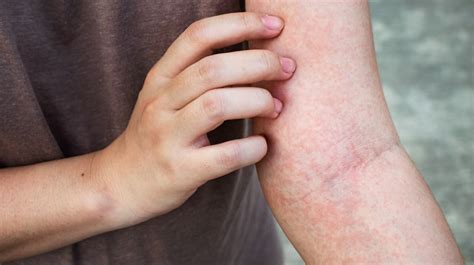 If Your Skin Is Often Itchy Or Inflamed You Should Check Out This