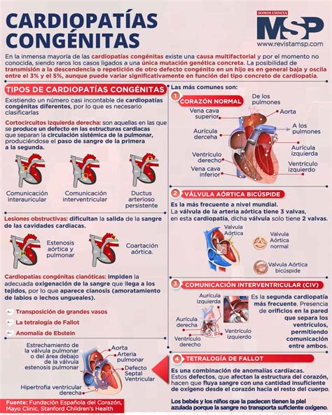 Cardiopatías Congénitas Infografía