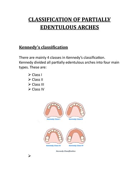 Kennedys Classification Kennedy Divided All Partially Edentulous