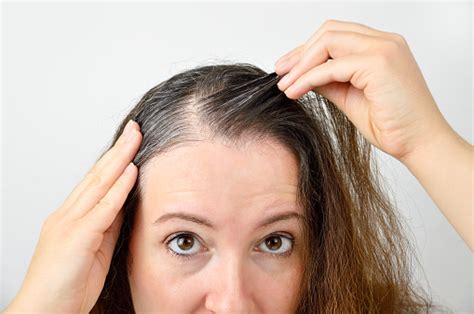 Why Some Women Have Gray Hair Earlier Chester County Hospital Penn Medicine