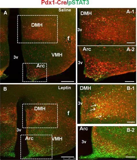 Pdx1 Cre Neurons Partially Overlap With Lepr Neurons Pdx1 Creai9 Mice