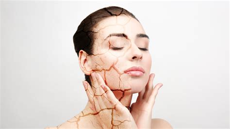 Top 10 Tips For Relieving Dry Skin