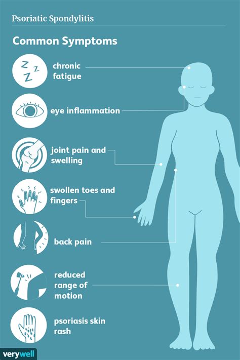 Psoriatic Spondylitis Symptoms Causes Diagnosis Treatment