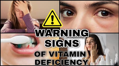 5 Signs Your Body Is Deficient Of Major Vital Nutrients Food Items