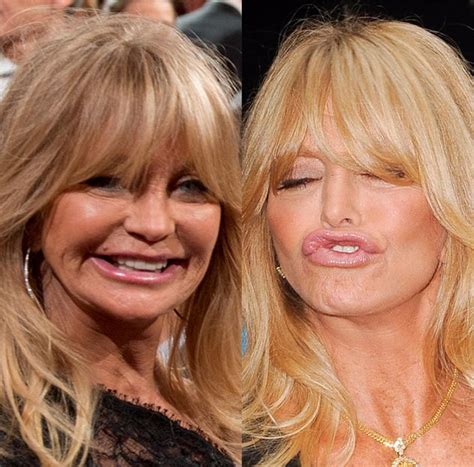 If you are using mobile phone, you could also use menu drawer from browser. The 70-year-old Goldie Hawn is rumored to have plastic ...