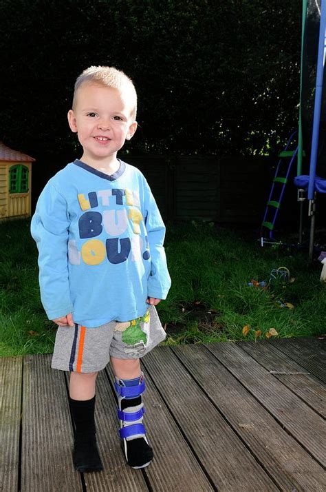 Boy With Lower Leg Brace Photograph By Science Photo Library