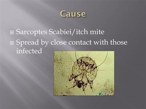 Ppt Scabies Powerpoint Presentation Free Download Id2638237