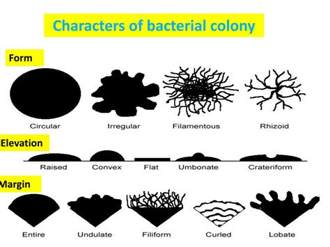 Solution Morphology Of Bacterial Colonies With Examples Studypool