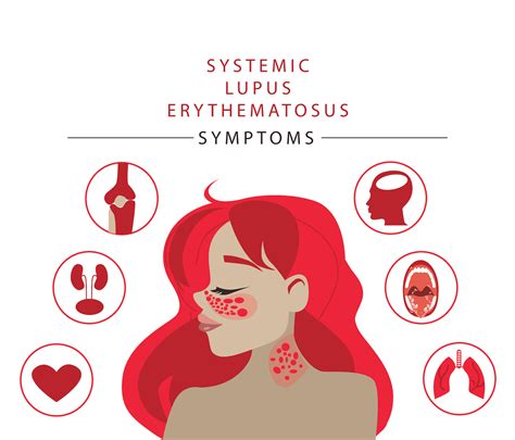 Lupus Causes Symptoms And Treatments