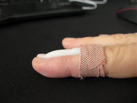 Place the injured arm or bent elbow over the triangle dangling down the chest. custom finger tip splint