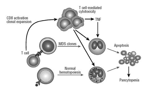 Autoimmune Mechanisms In The Pathophysiology Of Myelodysplastic