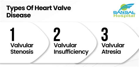 The Silent Danger Understanding Heart Valve Disease