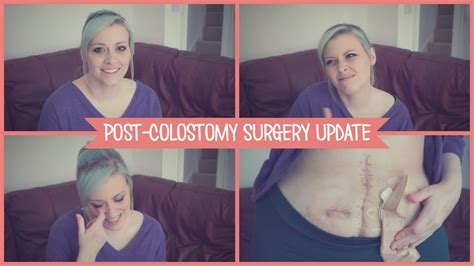 Post Colostomy Surgery Update Youtube