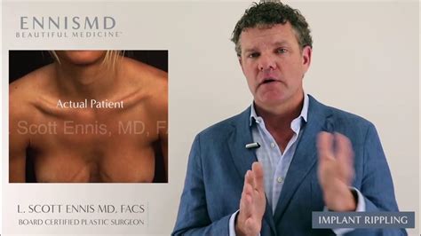 Saline Breast Implant Rippling By Dr L Scott Ennis Youtube