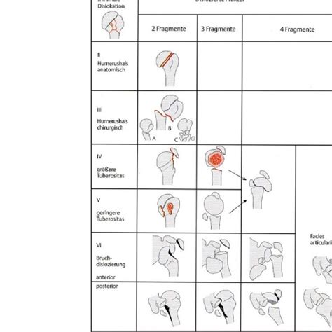 Neers Classification Download Scientific Diagram