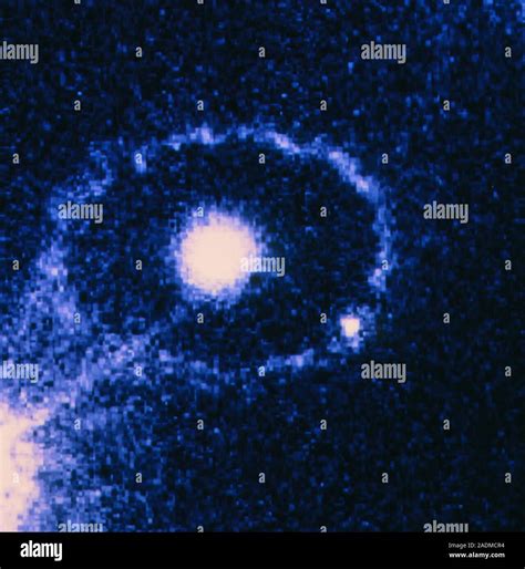 Supernova Sn 1987a Ultraviolet Image Taken By The Hubble Space