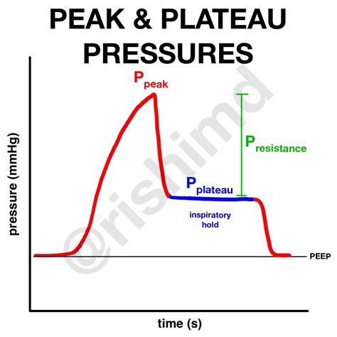 Peak Pressures vs Plateau Pressures | RK.md