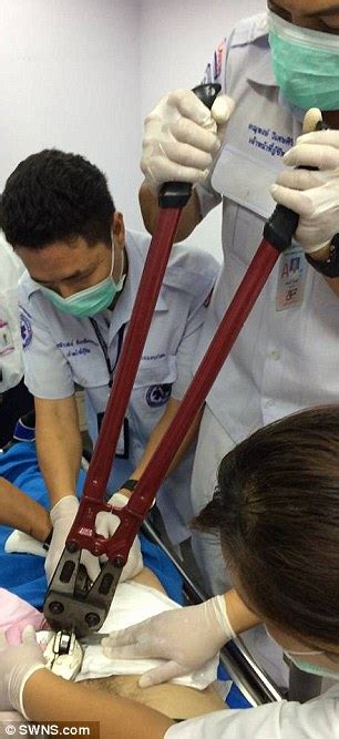 Its so hard to find good help, take my pool boy for example, he comes over to skim my pool and he stands out there like a idiot. Man Has Sex Ring Removed From Penis With Bolt Cutters (Photos)