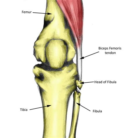 Biceps Femoris Tendon Avulsion Biceps Tendonitis Treatment Knee Injury