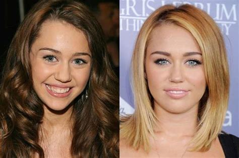 Miley Cyrus Nose Job Plastic Surgery Before And After Celebie