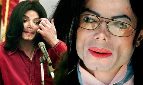 Michael Jackson Needed Life Threatening Surgery Just Before His