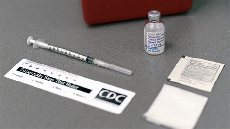 Nationwide Shortage Of Tuberculin Skin Test Antigens Cdc