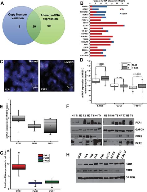 Fxr1 Is Overexpressed In Head And Neck Squamous Cell Carcinoma A