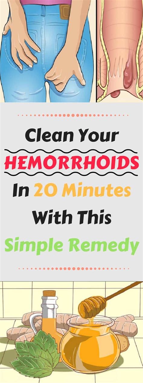 Clean Your Hemorrhoids In Just 20 Minutes With This Simple Remedy