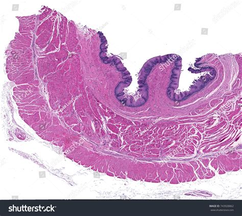 363 imágenes de Esophagus histology Imágenes fotos y vectores de