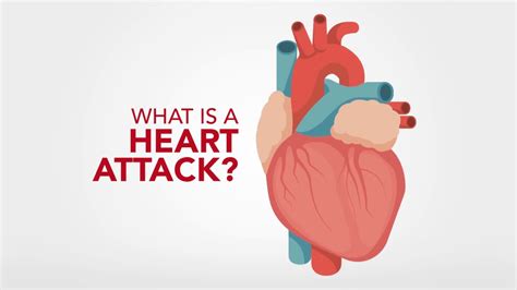 [Download 35+] Heart Attack Cartoon Images