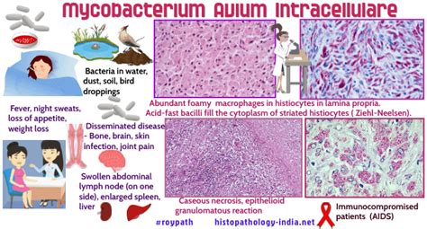 Pathology Of Mycobacterium Avium Intracellulare Infection Dr Sampurna