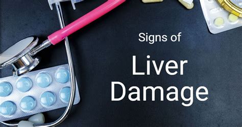 20 Symptoms Of Liver Damage You Should Not Ignore Facty Health