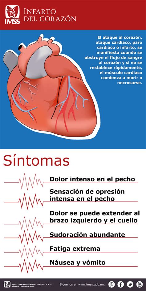 Infografía Infarto Del Corazón
