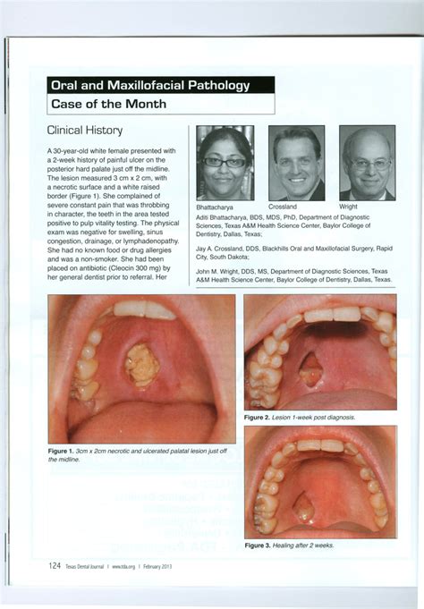 Pdf Oral And Maxillofacial Pathology Case Of The Month Diagnosis