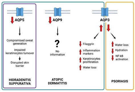 Ijms Free Full Text Aquaporins Are One Of The Critical Factors In