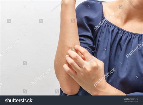 Women Scratch Itch Hand Concept HealthcareẢnh Có Sẵn522371410