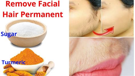 How To Remove Facial Hair Permanently At Home 100 Natural Home Remedy