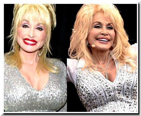 Dolly Parton Has Done Plastic Surgery To Almost All Her Body Parts