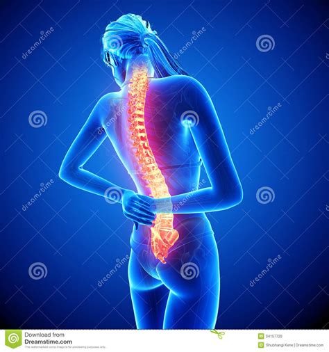 Download free photos of funny women. Female spine pain stock illustration. Illustration of ...