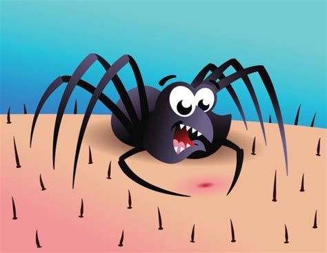Spider Bite Illustrations Royalty Free Vector Graphics And Clip Art Istock