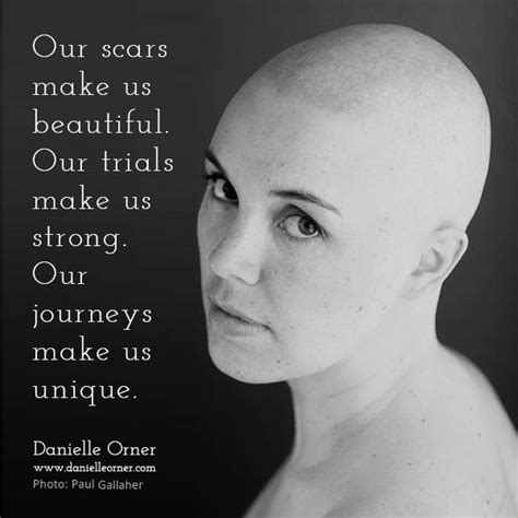 Quotes About Scars 372 Quotes