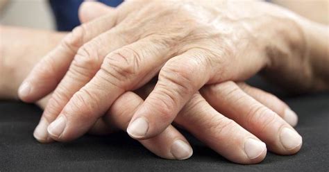 Natural Ways To Help Rheumatoid Arthritis Symptoms At Home Rheumatoid