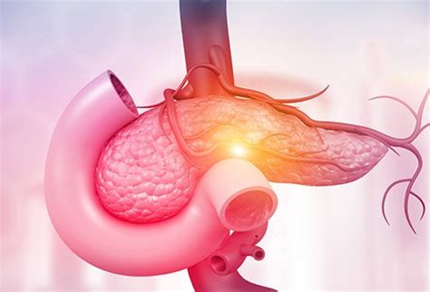 Symptoms can include feeling thirsty and hungry, and having to urinate often. What Are the Early Warning Signs of Pancreatic Cancer?